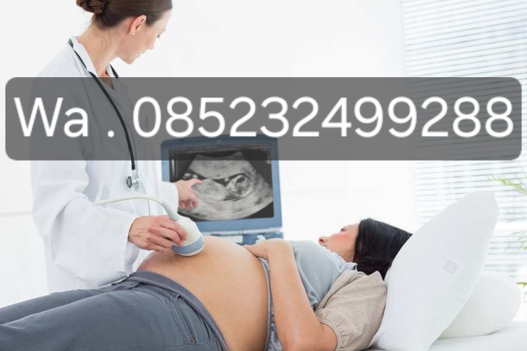 Metode Aman & Cepat Menggugurkan Kehamilan 1-8 Bulan secara Alami